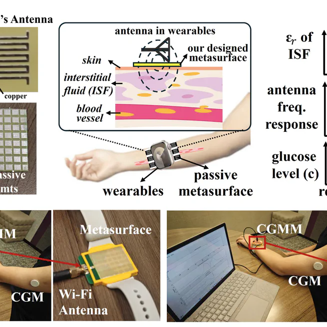 CGMM: Non-Invasive Continuous Glucose Monitoring in Wearables Using Metasurfaces